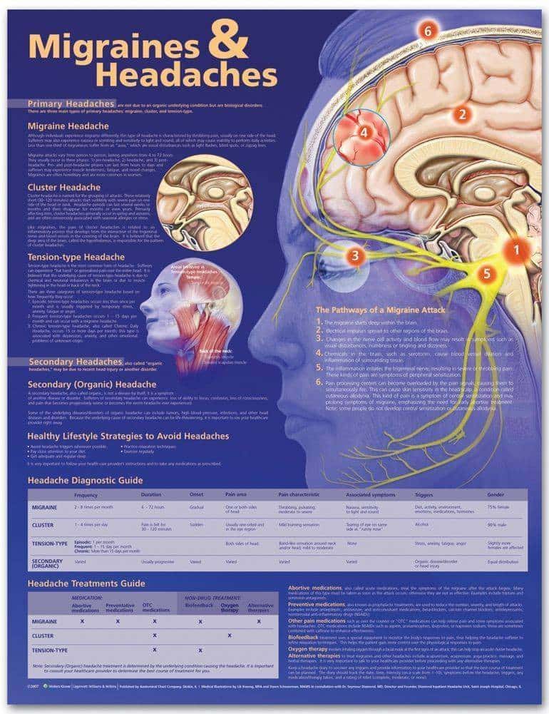Anatomical Chart Company Migraine and Headaches Laminated Anatomical ...