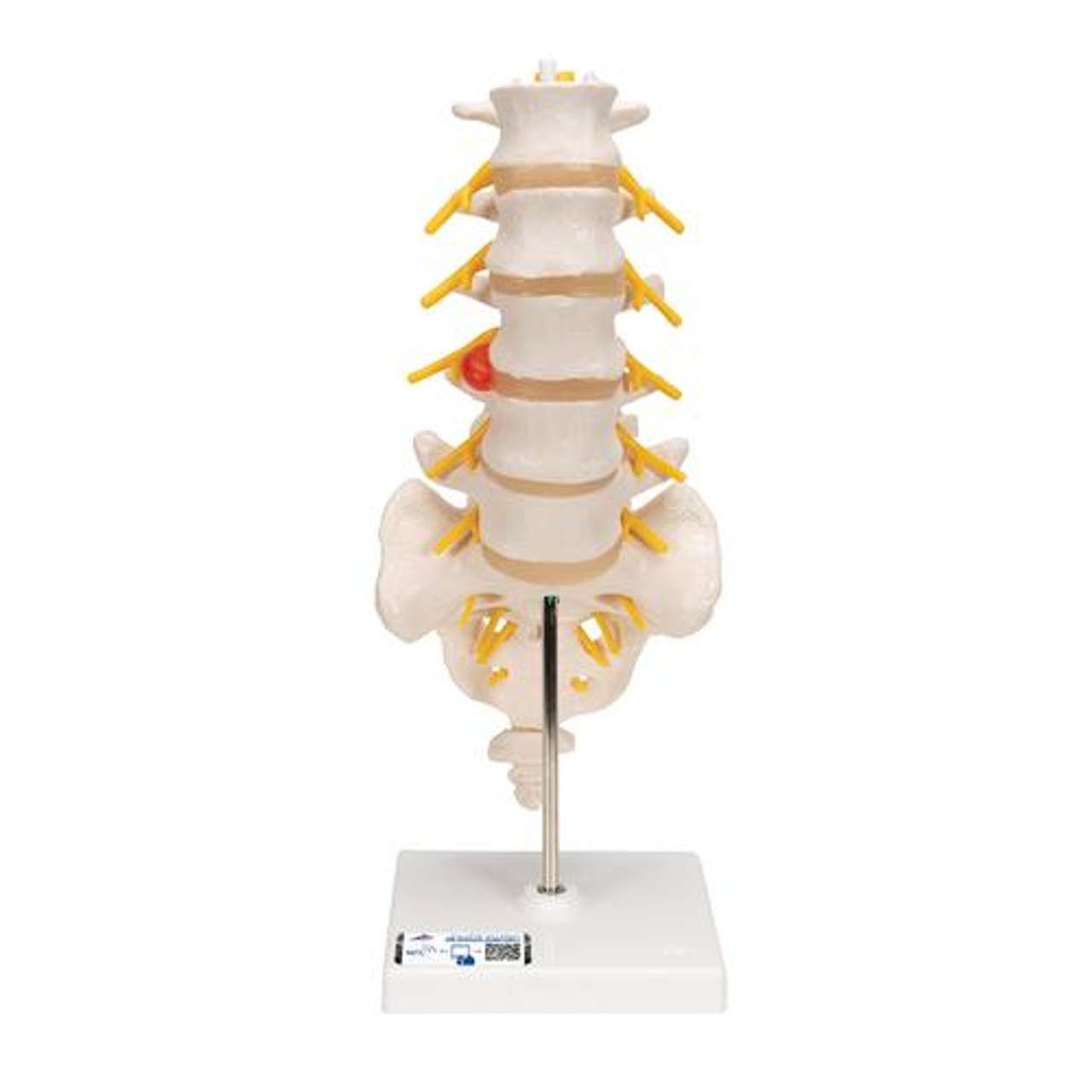 3B Anatomical Model - 2 Lumbar Vertebrae with prolapsed disc 3B Anatomical Model - 2 Lumbar Vertebrae with prolapsed disc