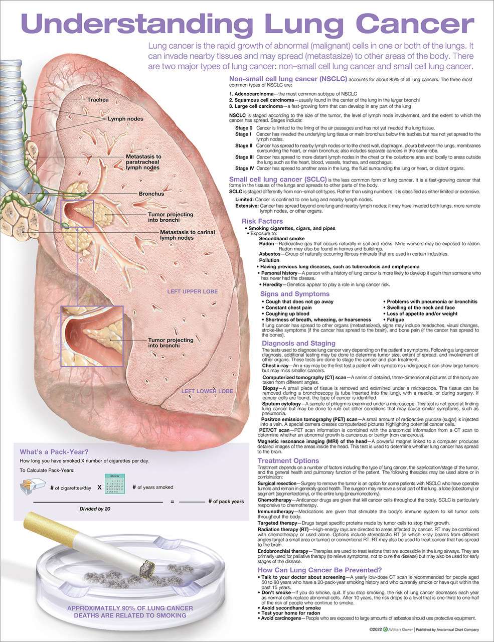 3B Anatomical Chart - Stroke Chart 20 x2 6'' 3B Anatomical Chart - Stroke Chart 20 x2 6''