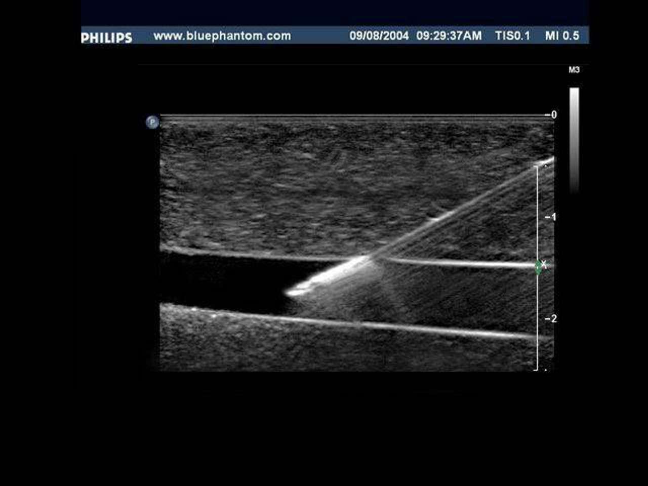Blue Phantom Pediatric 4 Vessel Ultrasound Training Block