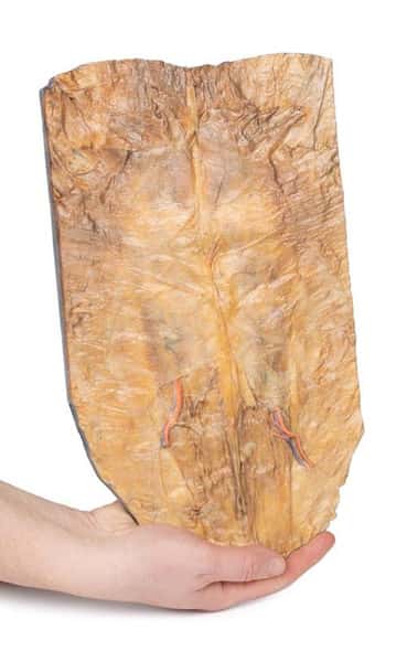 3D Printed Internal Abdominal Wall 3D Printed Internal Abdominal Wall 1