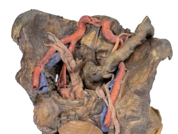 3D Printed Female Pelvis Deep Dissection 3D Printed Female Pelvis Deep Dissection