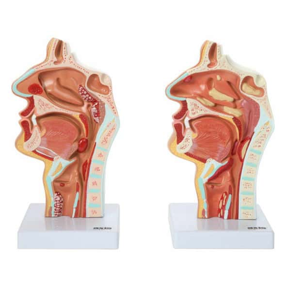 Axis Scientific Larynx and Pharynx Disorders Model Axis Scientific Larynx and Pharynx Disorders Model