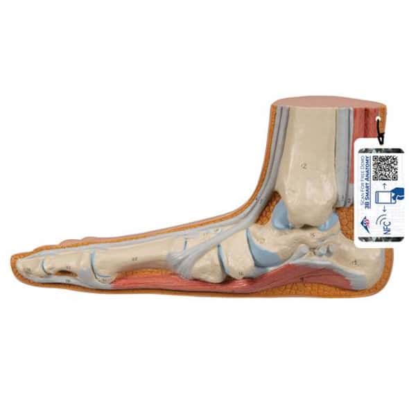 Flat Foot Pes Panus Anatomy Model Flat Foot Pes Panus Anatomy Model