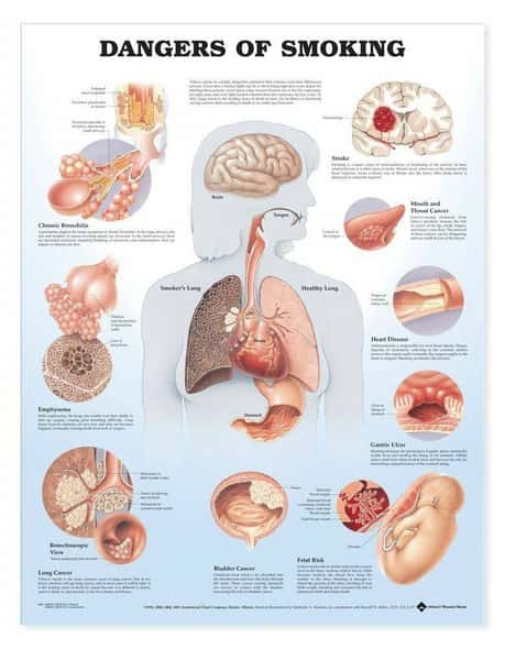 Dangers Of Smoking Laminated Anatomical Chart Dangers Of Smoking Laminated Anatomical Chart