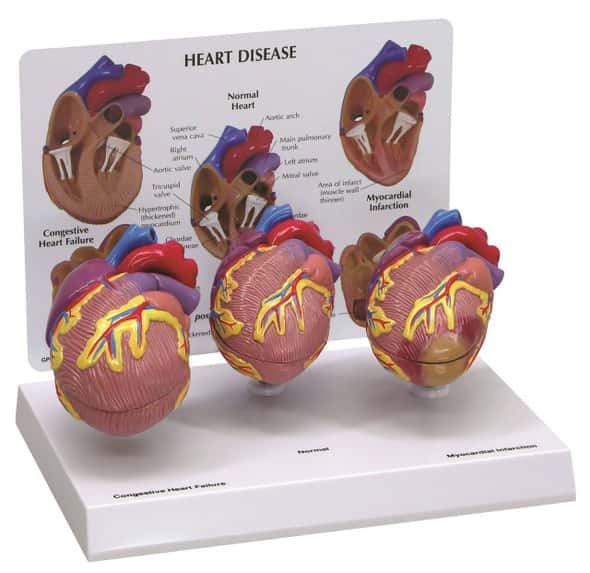 3 Piece Mini Heart Anatomy Models Set 3 Piece Mini Heart Anatomy Models Set