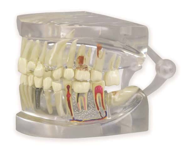 Clear Human Jaw with Teeth Anatomy Model Clear Human Jaw with Teeth Anatomy Model