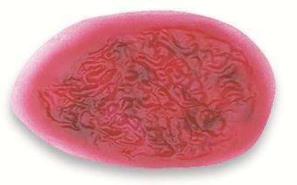 Large Sepsis Wound Stick-On Large Sepsis Wound Stick-On