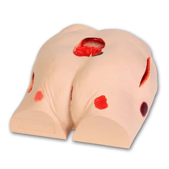 Seymour II Wound Care Model Seymour II Wound Care Model