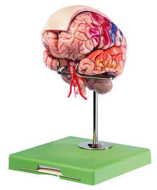 SOMSO Brain with Arteries, Falx Cerebri and Indicated Cytoarchitectural Areas Anatomy Model