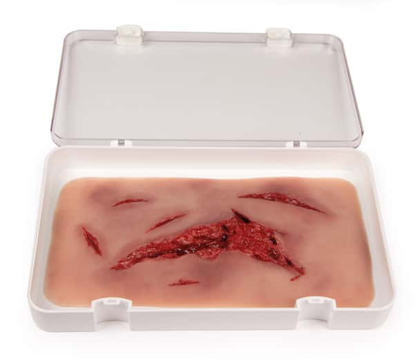 Skin Moulage, Large Laceration Wound - Bleeding