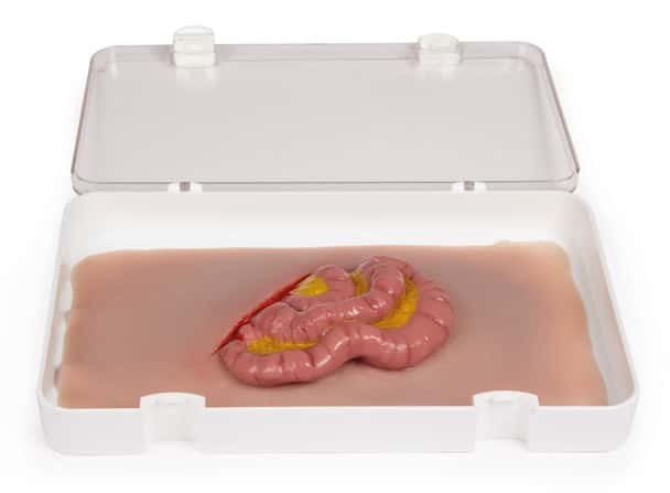Skin Moulage, Protrusion of Small Intestines