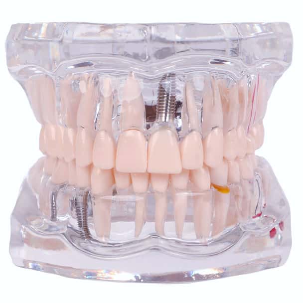 Axis Scientific Transparent Permanent Teeth Anatomy Model