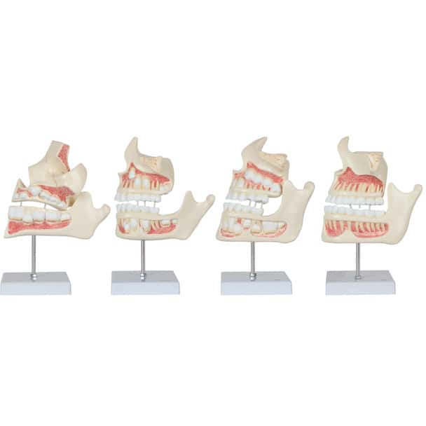 Axis Scientific Human Dental Development Anatomy Model