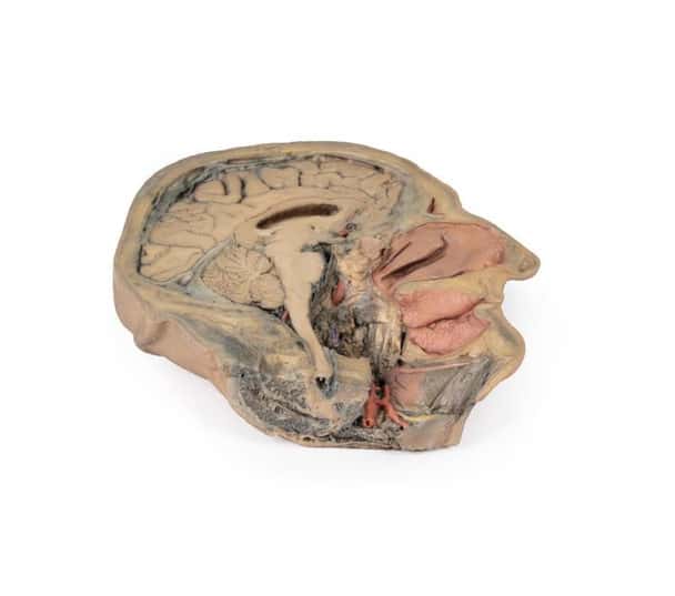 3D Printed Median Section Through Sagittal Section of Head with Deep Dissection