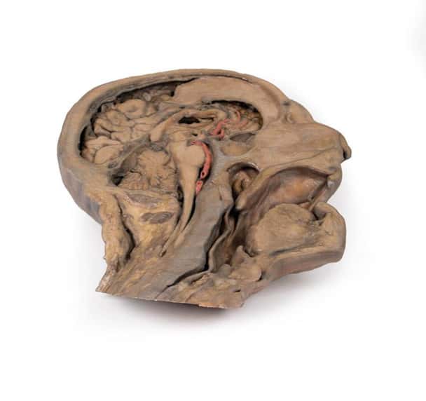3D Printed Parasagittal Section of the Head and Neck
