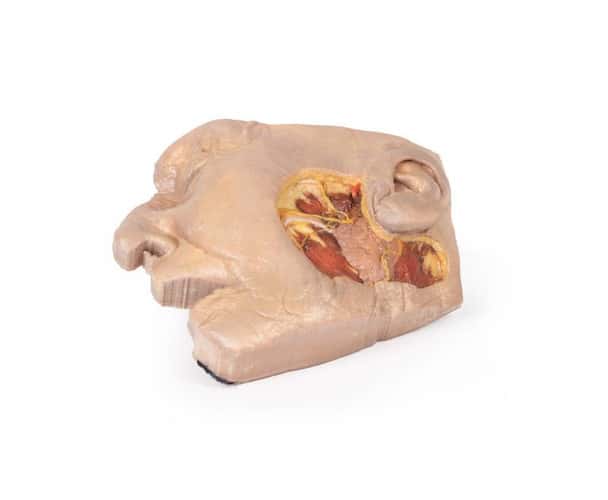 3D Printed Parotid Gland and Facial Nerve Dissection