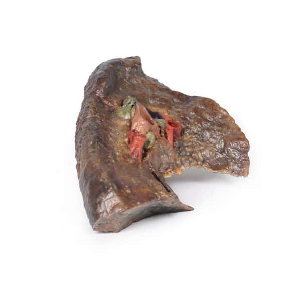 3D Printed Hilum of the Left Lung