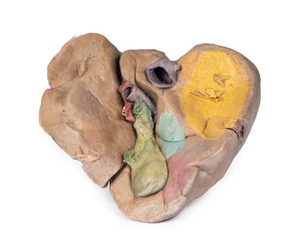 3D Printed Liver with Vessels and Gallbladder