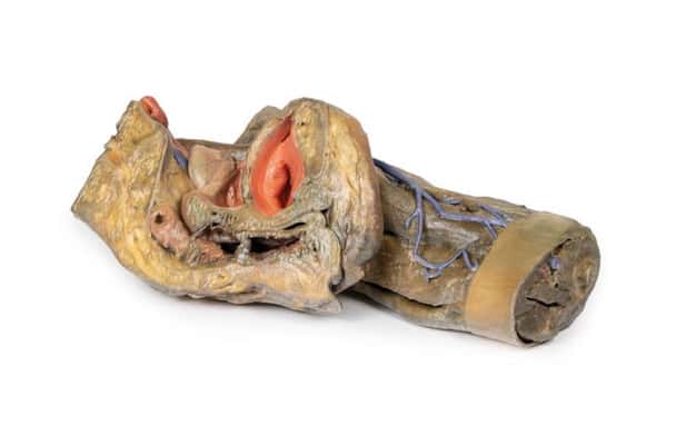 3D Printed Female Hemipelvis and Thigh