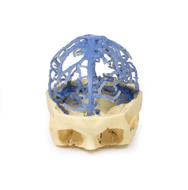 3D Printed Venous Circulation of the Brain