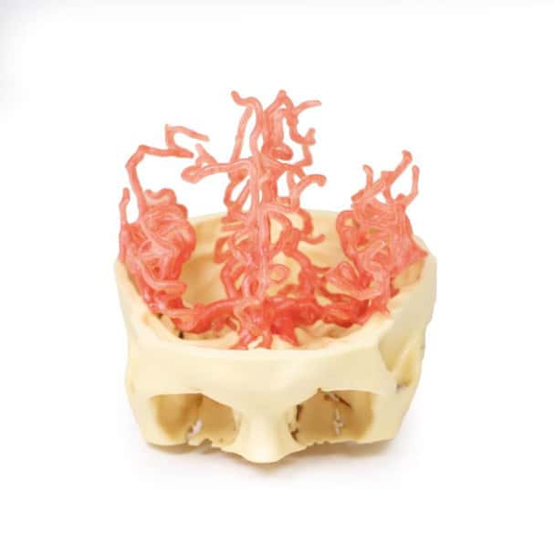 3D Printed Arterial Circulation of the Brain