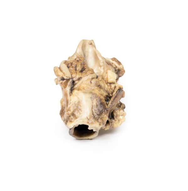 3D Printed Carcinoma of Pyriform Fossa