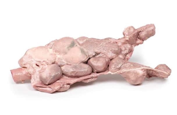 3D Printed Aorta and Para-Aortic Lymph Nodes