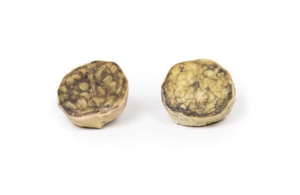 3D Printed Nodular Hyperplasia of the Prostate