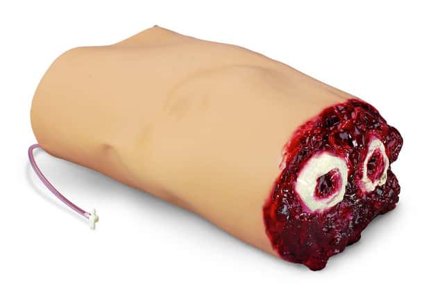 Amputated Bleeding Arm Add-On for SMART STAT Complete Adult Patient Simulator - Light