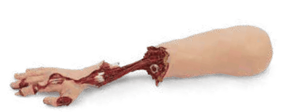 Xtreme Trauma Bleeding Arm Add-On for SMART STAT Basic Simulator