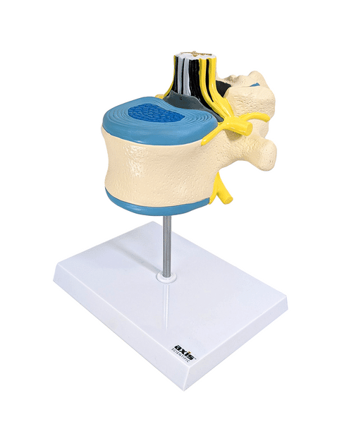 Axis Scientific Enlarged Lumbar Vertebrae with Spinal Cord and Nerves