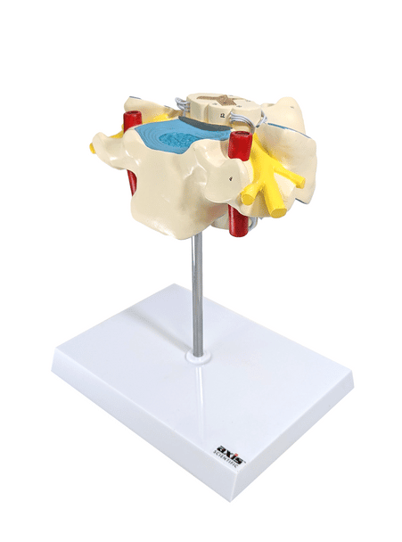 Axis Scientific Enlarged Cervical Vertebrae with Spinal Cord and Nerves