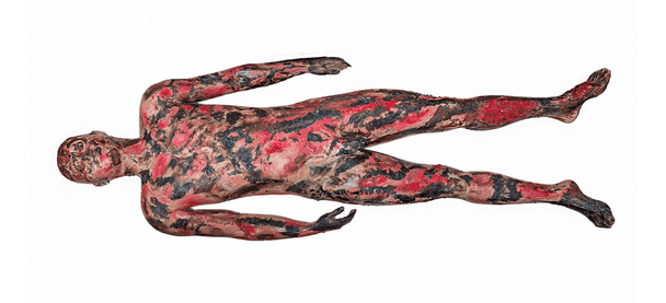 Anatomy Lab Full-Body Burn Assessment Manikin
