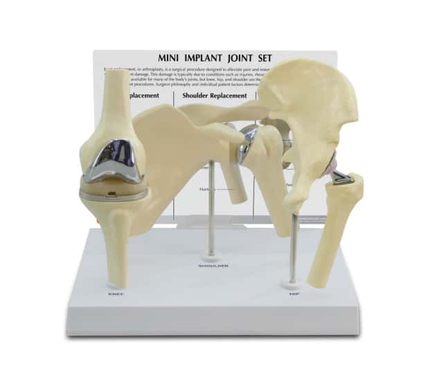 Mini Implant Joint Anatomy Model Set Overview