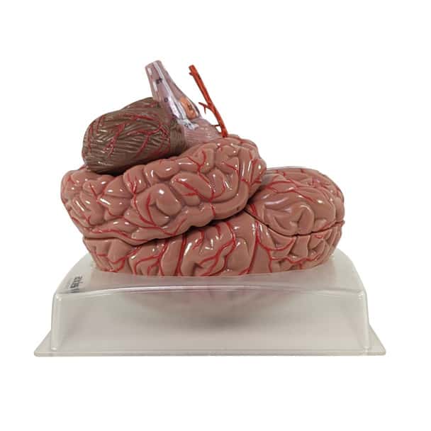 Axis Scientific 9-Part Deluxe Human Brain with Arteries