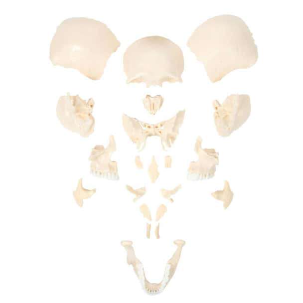Axis Scientific Life-Size 22-Part Disarticulated Human Skull Anatomy Model 22-Part Skull