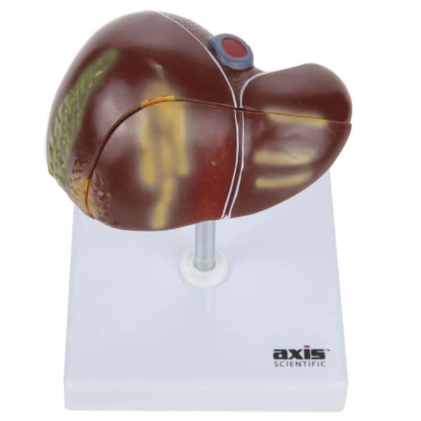 Axis Scientific Diseased Liver Model