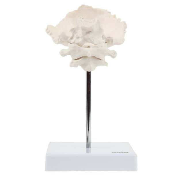 Axis Scientific Occipital Bone - C1 and C2