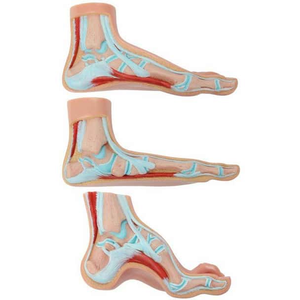 Axis Scientific Set of 3 Feet - Flat Foot, Arched Foot and Normal Foot