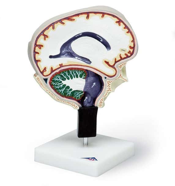 Cerebrospinal Fluid Brain Model