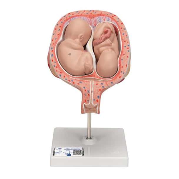 5th Month Human Twin Fetus Model