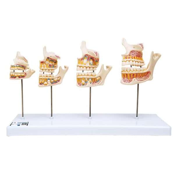 Dentition Development Anatomy Model On Stand