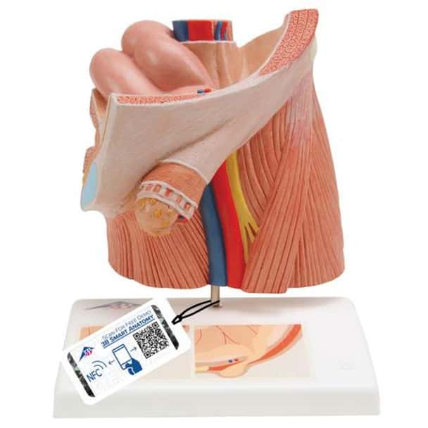 Male Inguinal Hernia Anatomy Model
