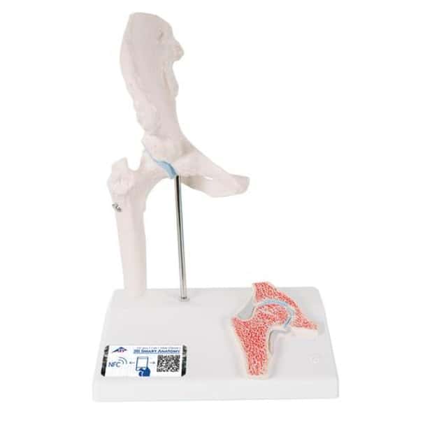 Mini Hip Joint with Cross Section Anatomy Model