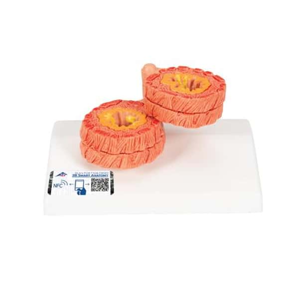 COPD Model