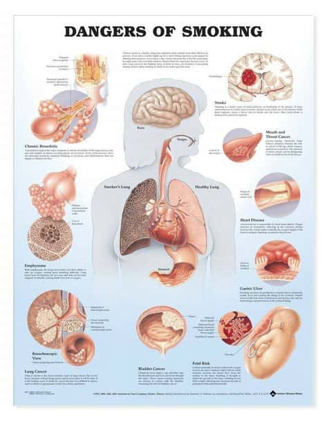 Dangers Of Smoking Laminated Anatomical Chart