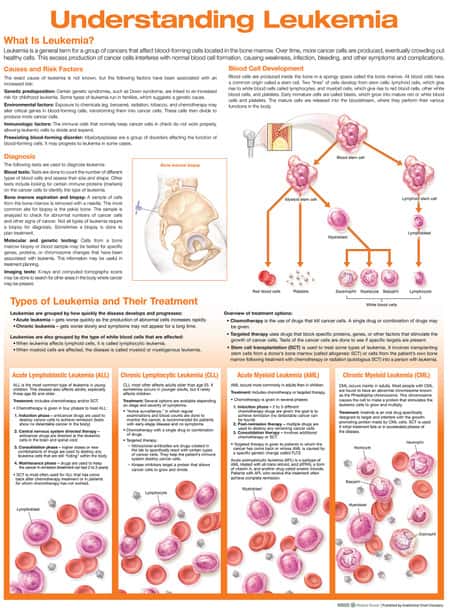 Understanding Leukemia Laminated Anatomical Chart, 2nd Edition