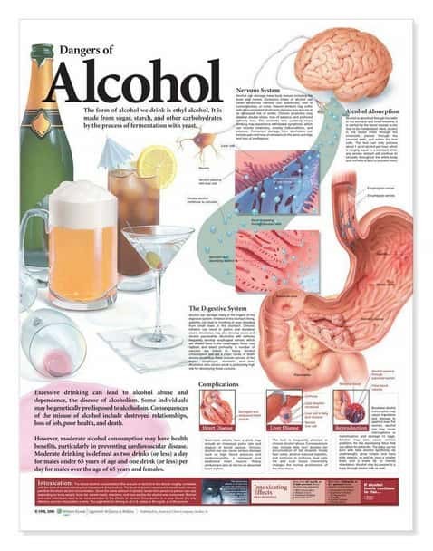 Dangers Of Alcohol Laminated Anatomical Chart - 2nd Edition