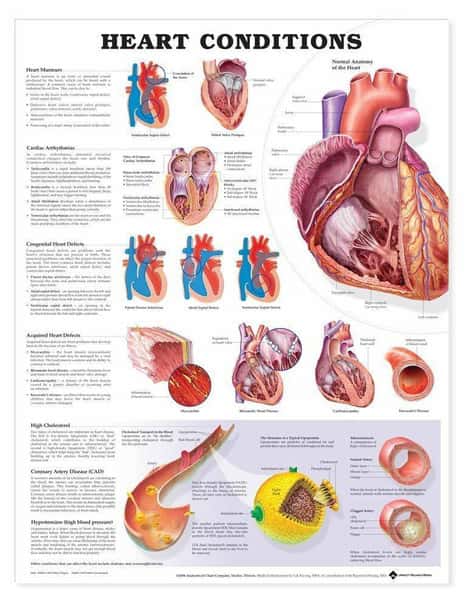 Heart Conditions Laminated Anatomical Chart
